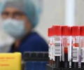 Российские ученые создали импортонезависимую методику анализа антикоагулянтов