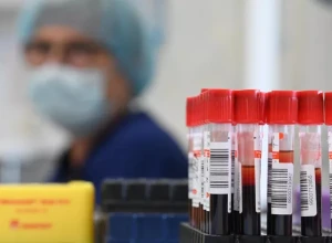 Российские ученые создали импортонезависимую методику анализа антикоагулянтов